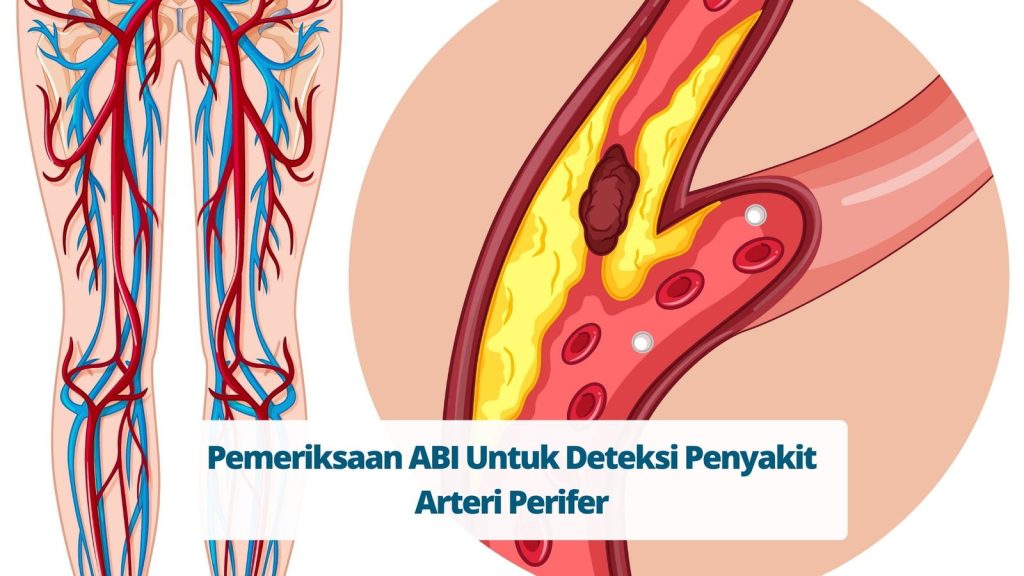 Cara Mendeteksi Penyakit Arteri Perifer Panduan Lengkap Untuk Kesehatan Vaskular Anda