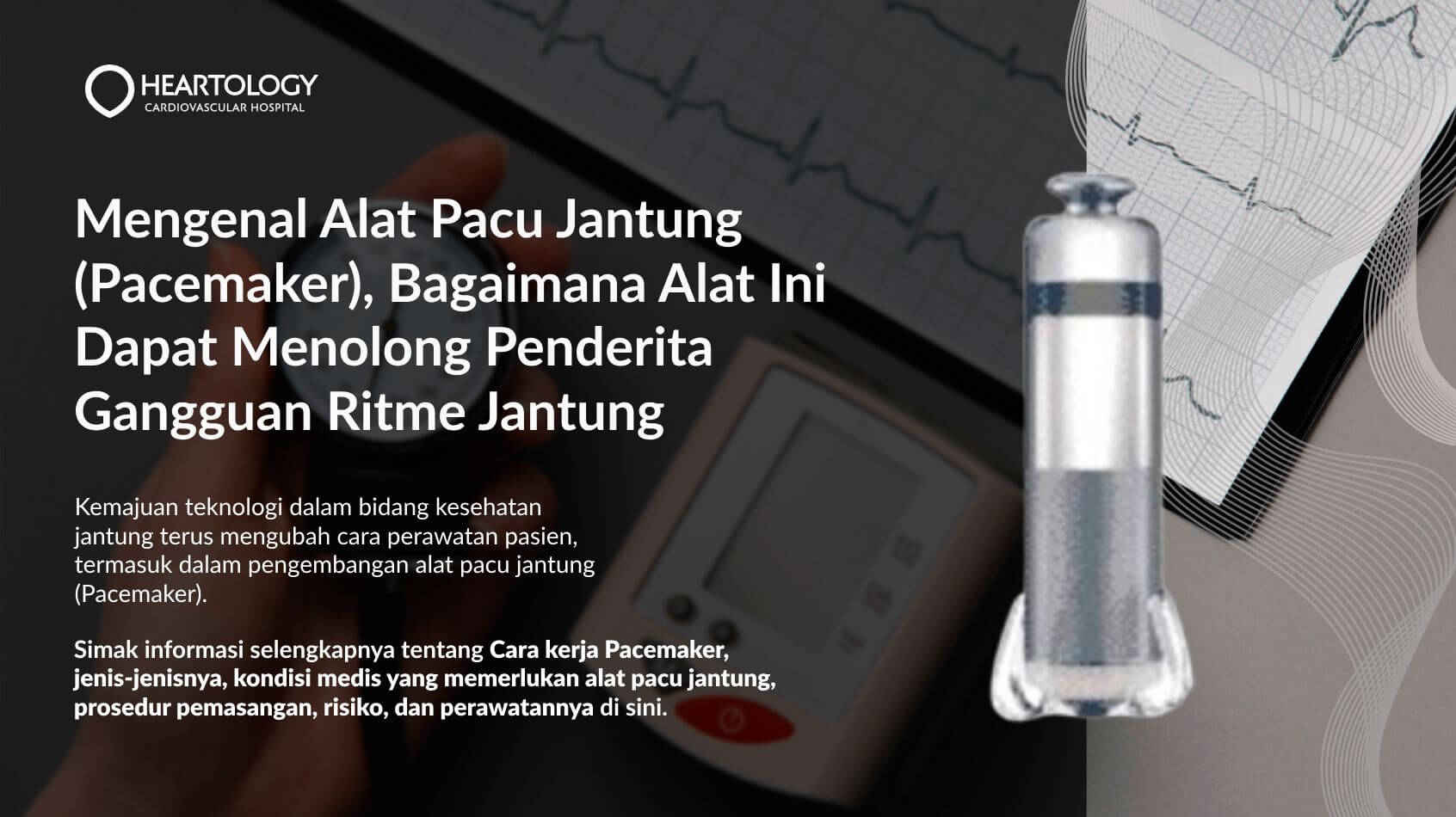 Mengenal Teknologi Alat Pacu Jantung Terbaru Sebuah Panduan Lengkap